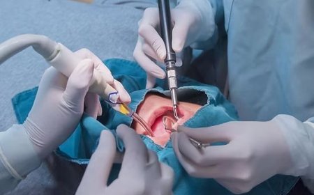 പല്ലില്‍ ക്ലിപ്പ് ഇടുന്നതിനിടയില്‍ നാവിനടിയില്‍ ഡ്രില്ലര്‍ തുളച്ചു കയറി; ആശുപത്രിക്കെതിരെ കേസ്