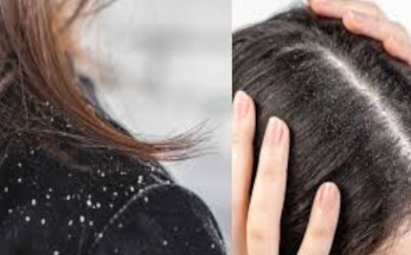 താരൻ അകറ്റി ഇടതൂർന്ന മുടി സ്വന്തമാക്കാൻ ഈ സിറം ബെസ്‌റ്റാ