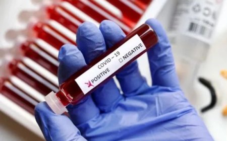 സംസ്ഥാനത്ത് കൊവിഡ് കേസുകള്‍ 430, രണ്ട് മരണം, രോഗബാധിതരേറെ ഈ ജില്ലകളില്‍