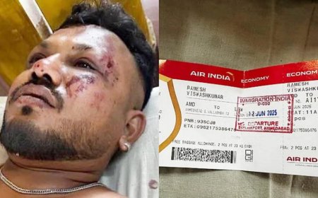 അഹമ്മദാബാദ് വിമാനാപകടത്തിൽ നിന്നും രക്ഷപ്പെട്ട വിശ്വാസ് കുമാർ രമേശിന്റെ ആരോ​ഗ്യനില തൃപ്തികരം