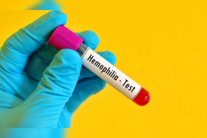 ഹീമോഫീലിയ ബാധിതയായ സ്ത്രീക്ക് രാജ്യത്ത് ആദ്യമായി എമിസിസുമാബ് പ്രൊഫൈലാക്സിസ്  നൽകി കേരളം