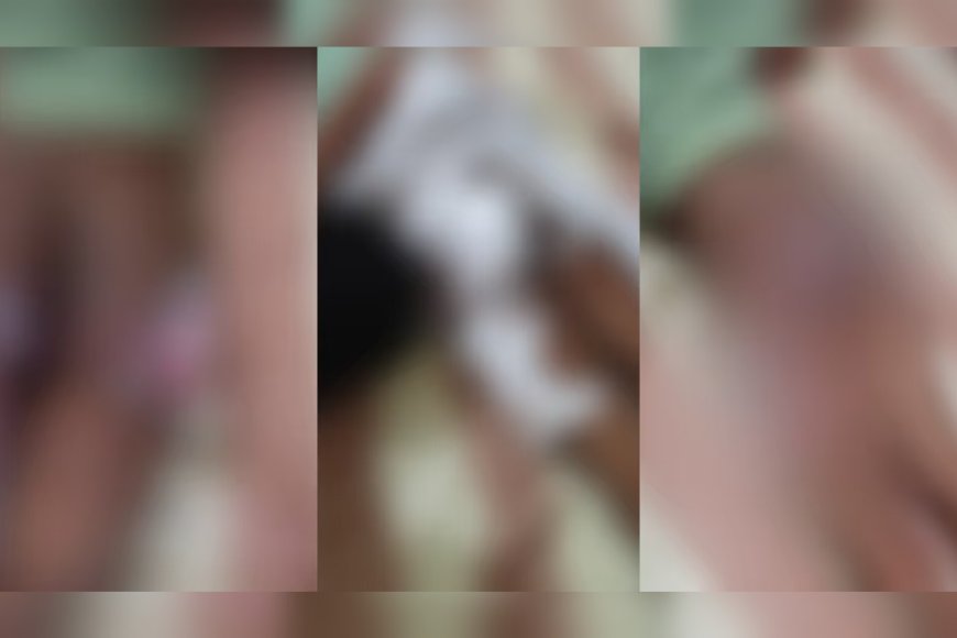 കായംകുളത്ത് നാലര വയസുകാരനെ ചട്ടുകം കൊണ്ട് പൊള്ളിച്ചു