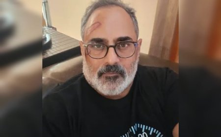 ട്രെഡ്മില്ലില്‍ നിന്ന് വീണ് രാജീവ് ചന്ദ്രശേഖറിന് പരുക്ക്