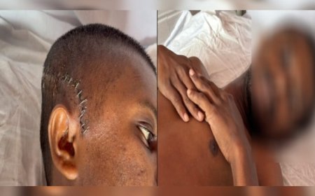 വേര് മോഷ്ടിച്ചെന്നാരോപിച്ച് മർദനം; അട്ടപ്പാടിയിൽ ആദിവാസി യുവാവിന് ക്രൂര മർദനം