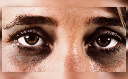 കണ്ണിന് താഴെയുള്ള കറുപ്പ് വെറും ഉറക്കക്കുറവല്ല; അവഗണിക്കരുതെന്ന് ആരോഗ്യ വിദഗ്ധർ