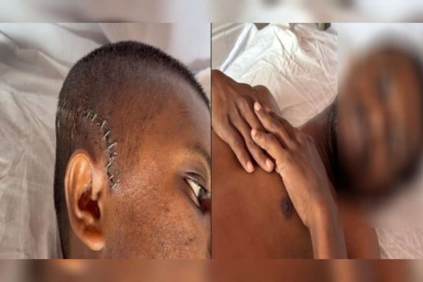 വേര് മോഷ്ടിച്ചെന്നാരോപിച്ച് മർദനം; അട്ടപ്പാടിയിൽ ആദിവാസി യുവാവിന് ക്രൂര മർദനം