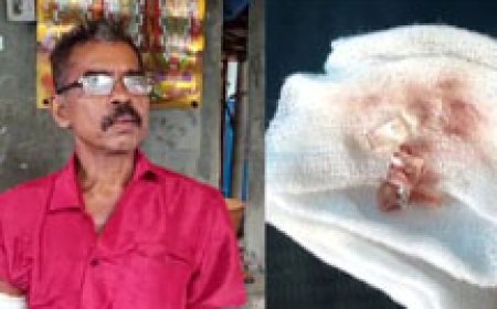 ചില്ലു നീക്കാതെ മുറിവ് വച്ചുകെട്ടി‌യെന്ന് പരാതി; ചേർത്തല താലൂക്ക് ആശുപത്രിക്കെതിരെ വീണ്ടും ചികിത്സാപിഴവ് ആരോപണം