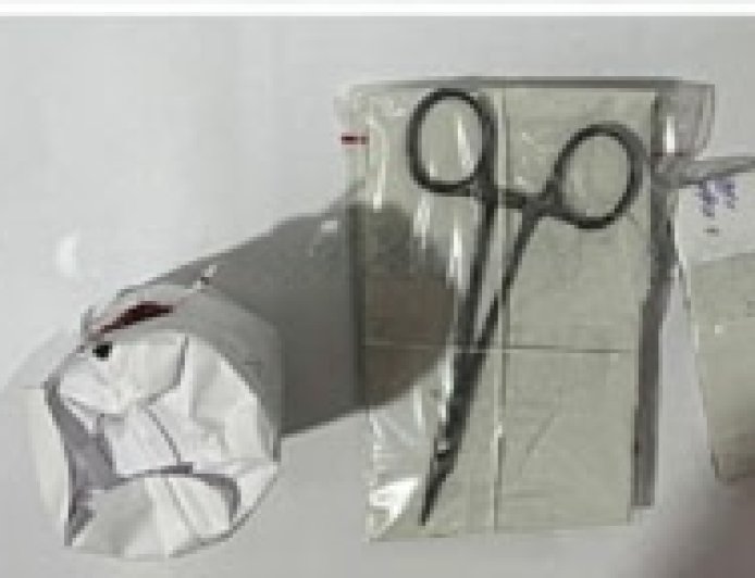 ആർട്ടറി ഫോർസെപ്സിന്റെ അ​ഗ്രഭാ​ഗം ഒടിഞ്ഞ നിലയിൽ; ഉഷയുടെ വയറ്റിലുണ്ടായിരുന്ന ഉപകരണം ഇതായിരുന്നു