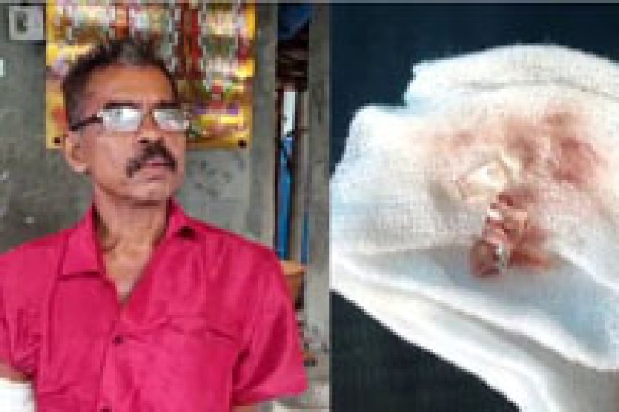 ചില്ലു നീക്കാതെ മുറിവ് വച്ചുകെട്ടി‌യെന്ന് പരാതി; ചേർത്തല താലൂക്ക് ആശുപത്രിക്കെതിരെ വീണ്ടും ചികിത്സാപിഴവ് ആരോപണം