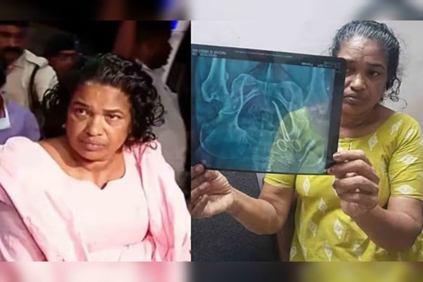 ഉഷയുടെ വയറ്റിൽനിന്ന് അഞ്ചുവർഷത്തിന് ശേഷം കത്രിക പുറത്തെടുത്തു; ശസ്ത്രക്രിയ പൂർത്തിയായി