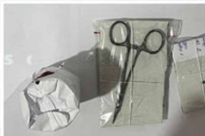 ആർട്ടറി ഫോർസെപ്സിന്റെ അ​ഗ്രഭാ​ഗം ഒടിഞ്ഞ നിലയിൽ; ഉഷയുടെ വയറ്റിലുണ്ടായിരുന്ന ഉപകരണം ഇതായിരുന്നു