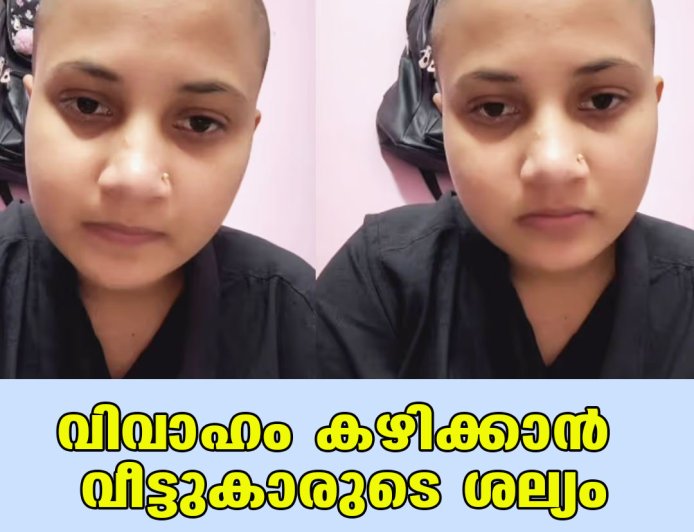 വിവാഹം കഴിക്കാന്‍ വീട്ടുകാരുടെ ശല്യം;ഒടുവില്‍ തല മൊട്ടയടിച്ച് യുവതി