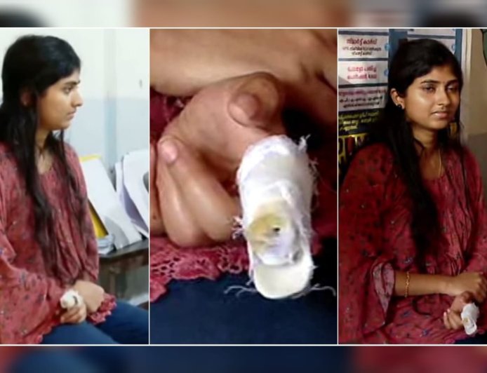 തൃശൂരിൽ ശസ്ത്രക്രിയ കഴിഞ്ഞ പെൺകുട്ടിക്ക് വോട്ട് നിഷേധിക്കാൻ നീക്കം; വിരലിൽ പരിക്കേറ്റതിനാൽ മഷി പുരട്ടാനാവില്ലെന്ന് ഉദ്യോഗസ്ഥർ; ഒടുവിൽ സിഇഒയുടെ ഇടപെടൽ