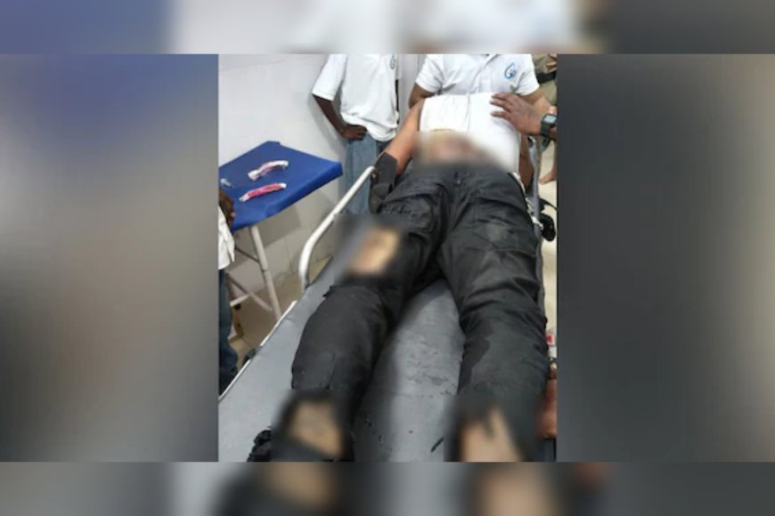 വെമ്പായം ബാർ തീകൊളുത്തൽ: പൊള്ളലേറ്റ നവാസ് മരിച്ചു
